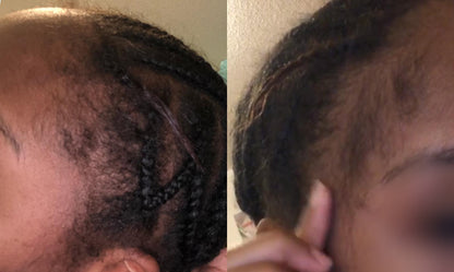 Intense Scalp Oil