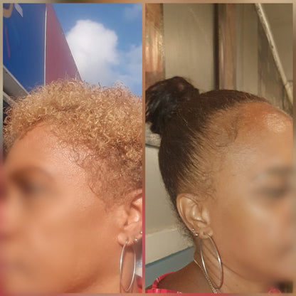 Intense Scalp Oil