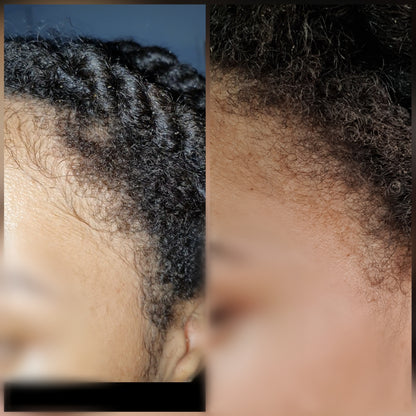 Intense Scalp Oil