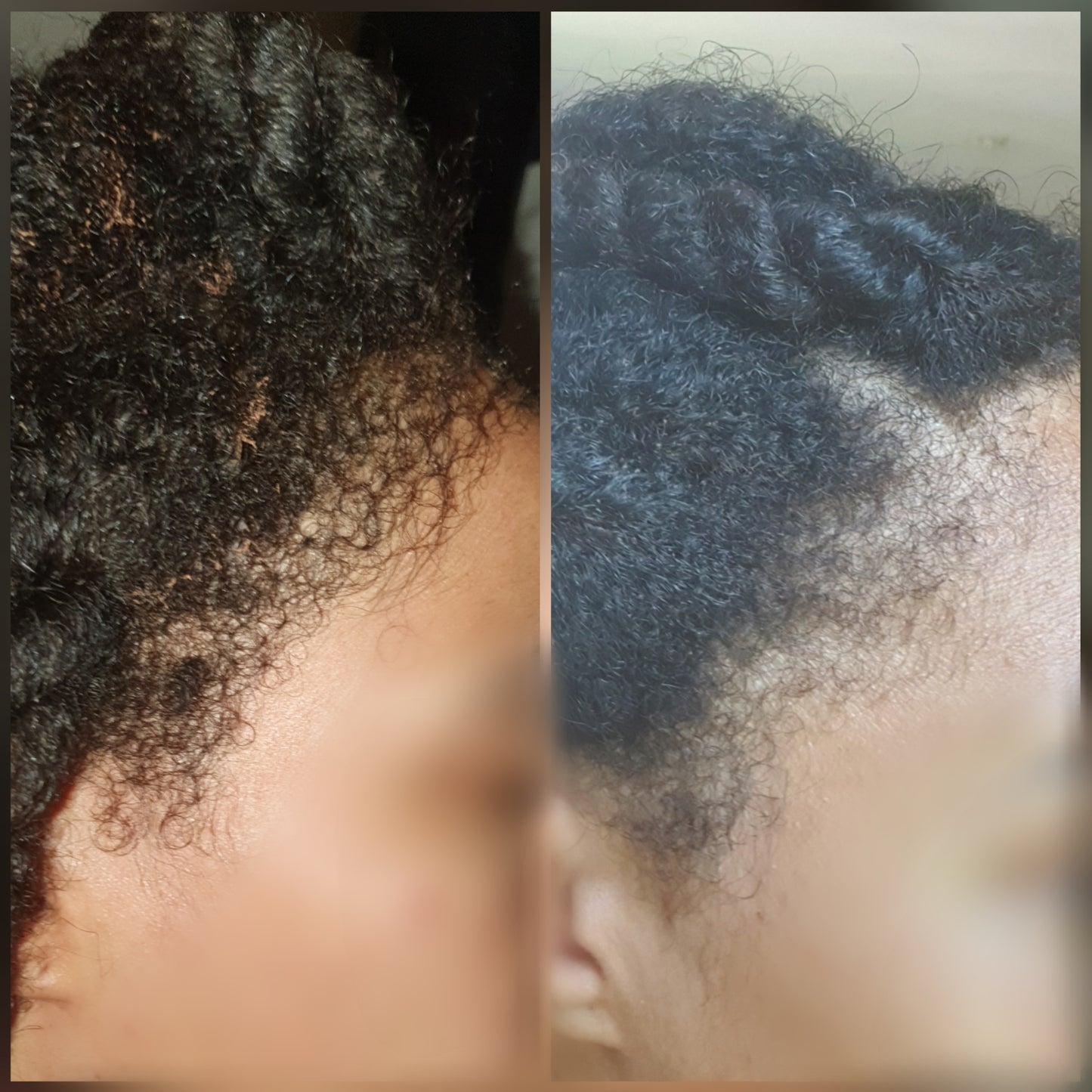 Intense Scalp Oil